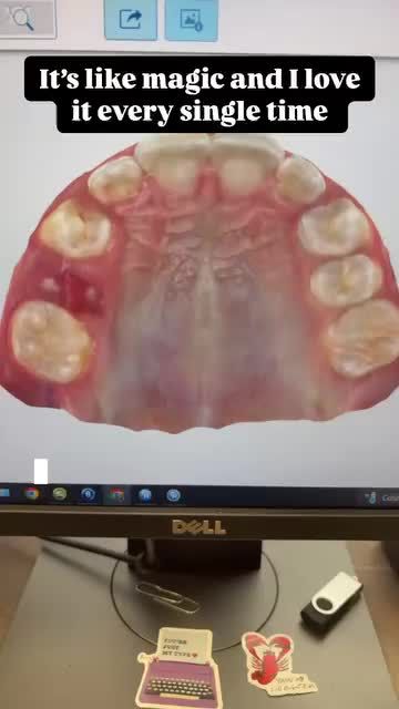 Video post by @weisstorortho on TikTok