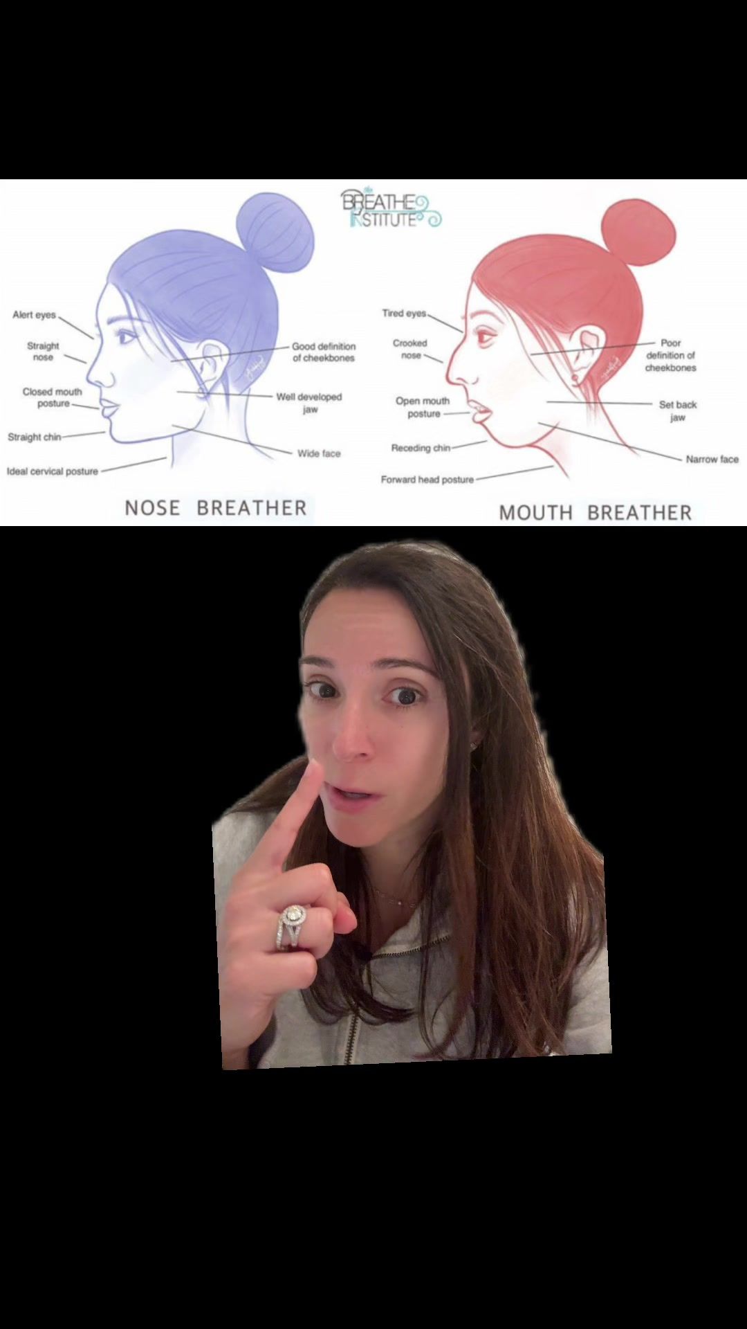 Video post by @weisstorortho on TikTok