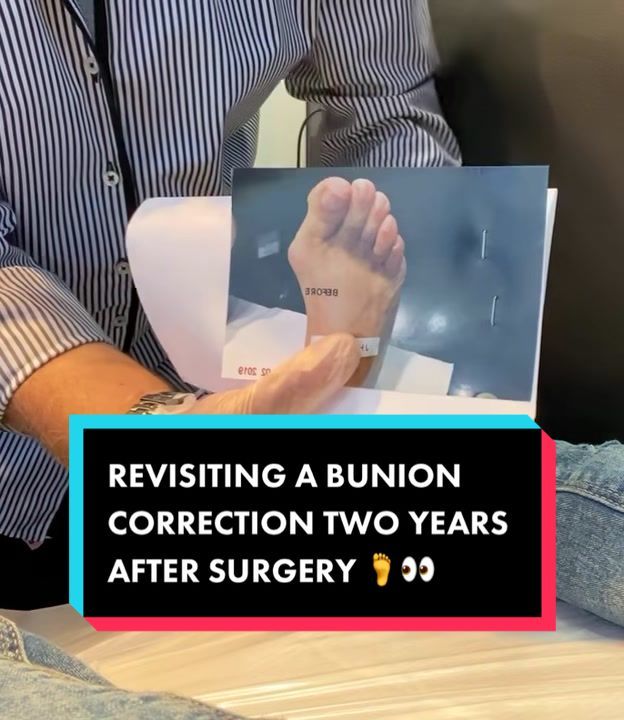 Video post by @bunionking1 on TikTok