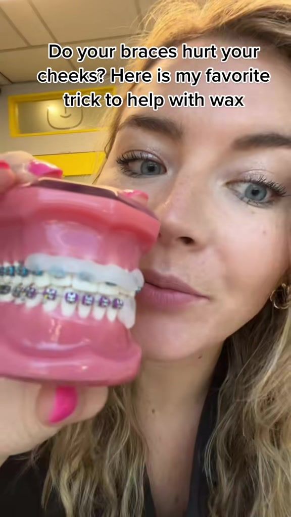 Video post by @bracesbysable on TikTok