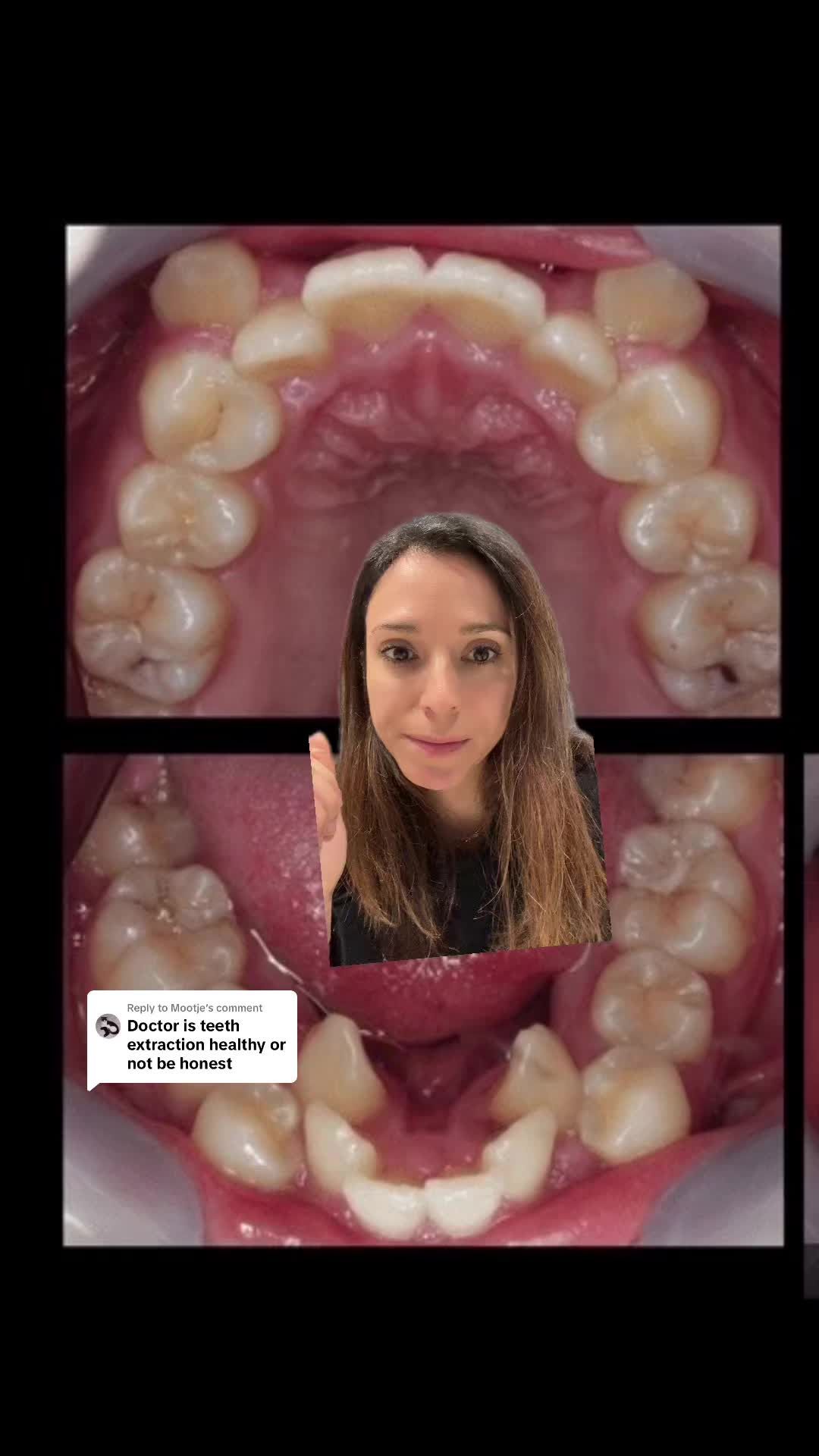 Video post by @weisstorortho on TikTok