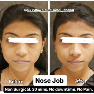 Image post by @nikkybawamedisalonbhopal on Instagram