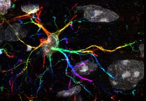 Image post by @chanzuckerberginitiative on Facebook