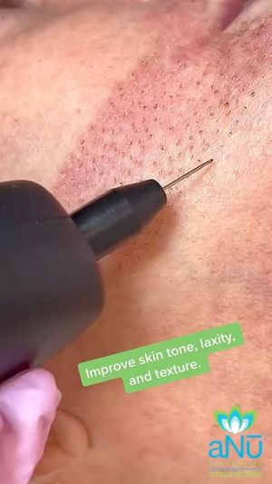 Video post by @anuaestheticsandwellness on Instagram