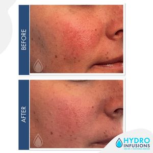 Image post by @hydromedspa on Facebook
