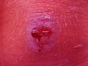 Image post by @corcoran_gw on Instagram