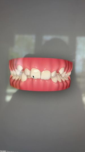 Video post by @weisstorortho on TikTok