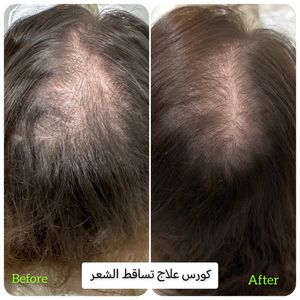 Image post by @dr.rafatalaker on Instagram