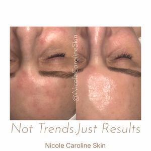 Image post by @nicolecarolineskin on Instagram