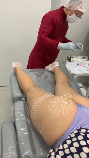 Video post by @drmikesilva on Instagram