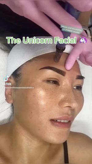 Video post by @anuaestheticsandwellness on Instagram