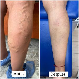 Image post by @dr.vicentevascular on Instagram