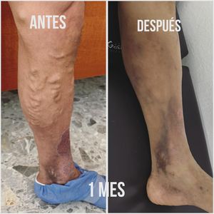 Image post by @dr.vicentevascular on Instagram