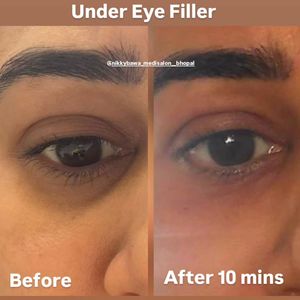 Image post by @nikkybawamedisalonbhopal on Instagram