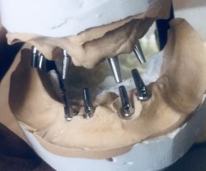 Image post by @dentamerzifon on Instagram