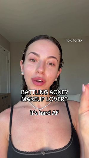 Video post by @anyaweitz on TikTok