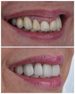 Image post by @sharpdentistry on Instagram