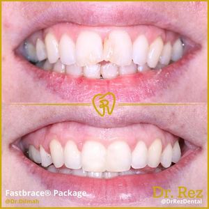 Image post by @drrezdental on Facebook