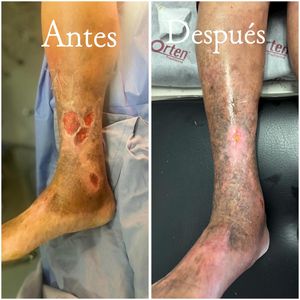 Image post by @dr.vicentevascular on Instagram