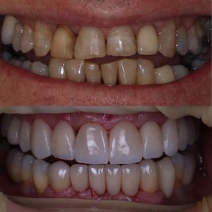 Image post by @dr.eduardo_balen on Instagram