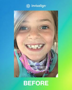 Image post by @invisalign on Instagram