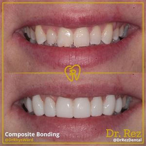 Image post by @drrezdental on Facebook