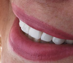 Image post by @sharpdentistry on Instagram