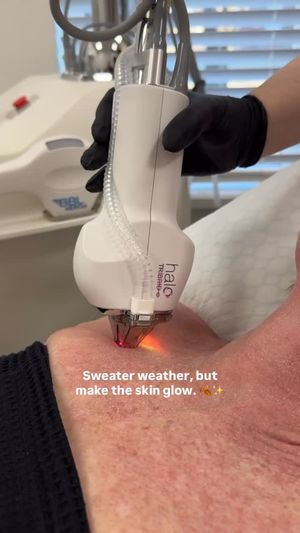 Video post by @sciton_inc on Instagram