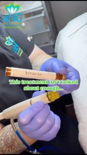 Video post by @anuaestheticsandwellness on Instagram
