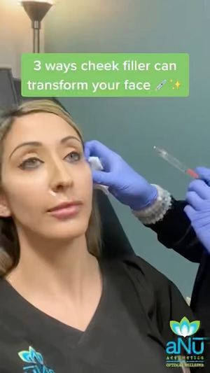 Video post by @anuaestheticsandwellness on Instagram