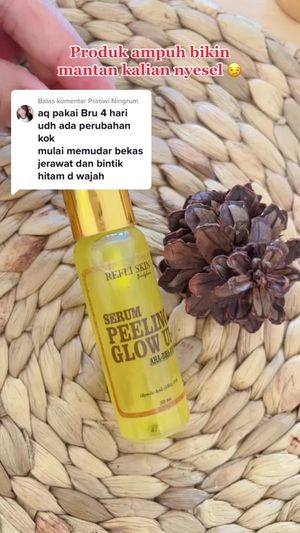 Video post by @lili.refliskin on TikTok