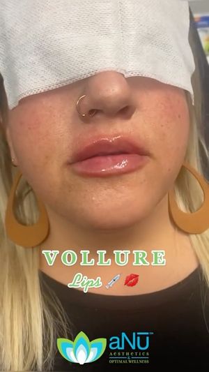 Video post by @anuaestheticsandwellness on Instagram