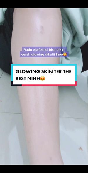 Video post by @lili.refliskin on TikTok