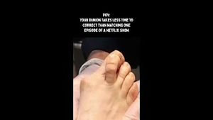 Video post by @thebunionking on YouTube