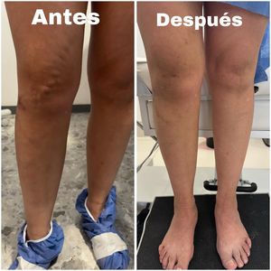 Image post by @dr.vicentevascular on Instagram