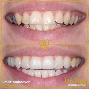 Image post by @drrezdental on Facebook