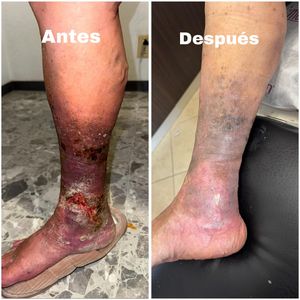 Image post by @dr.vicentevascular on Instagram