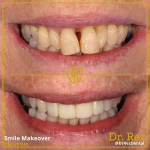 Image post by @drrezdental on Facebook