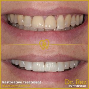 Image post by @drrezdental on Facebook