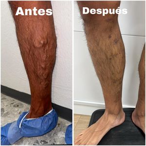 Image post by @dr.vicentevascular on Instagram