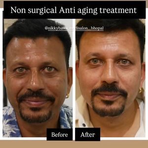 Image post by @nikkybawamedisalonbhopal on Instagram