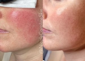 Image post by @nicolecarolineskin on Instagram