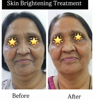 Image post by @nikkybawamedisalonbhopal on Instagram