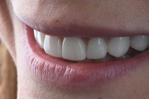 Image post by @sharpdentistry on Instagram