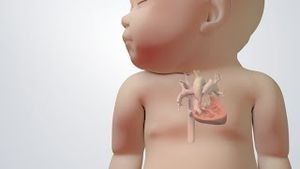 Video post by @nucleusmedicalmedia on YouTube