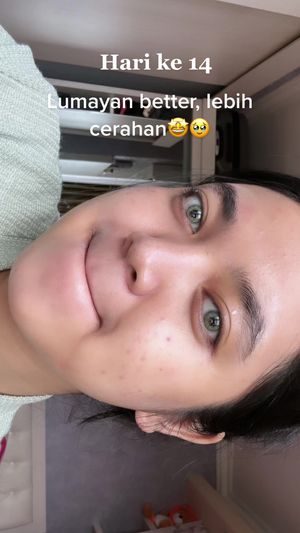 Video post by @sindi9rande on TikTok