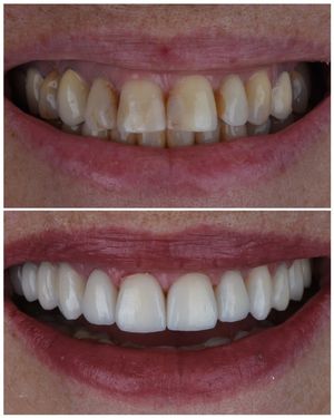 Image post by @sharpdentistry on Instagram