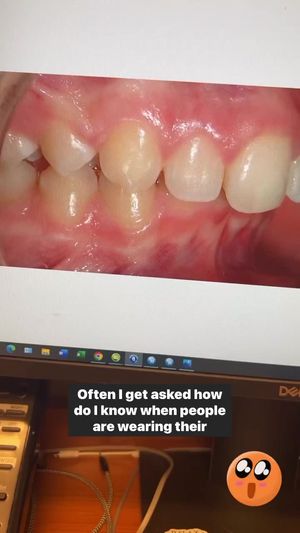 Video post by @weisstorortho on TikTok
