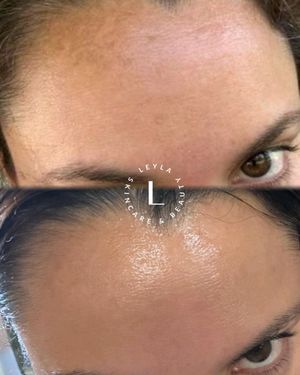 Image post by @leyla.skincareandbeauty on Instagram