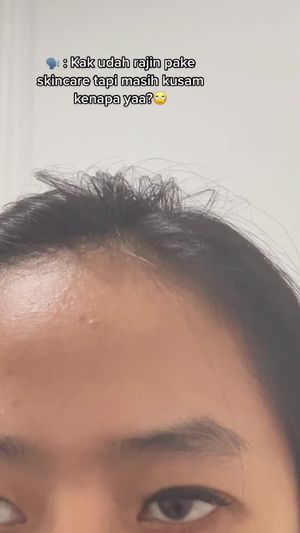 Video post by @lili.refliskin on TikTok